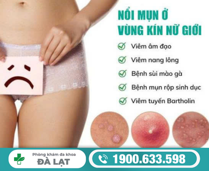 Hình ảnh minh họa